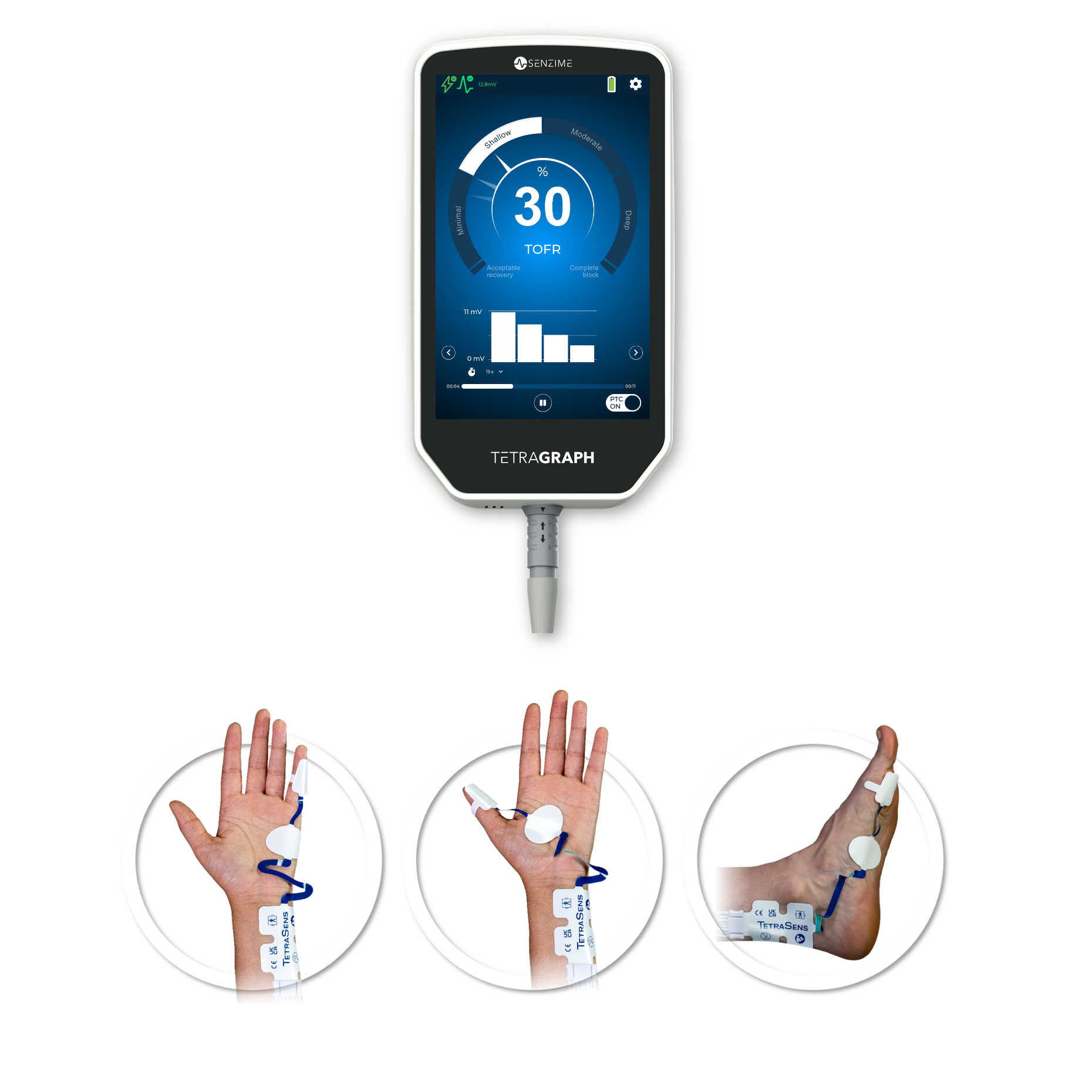 TetraGraph NextGen